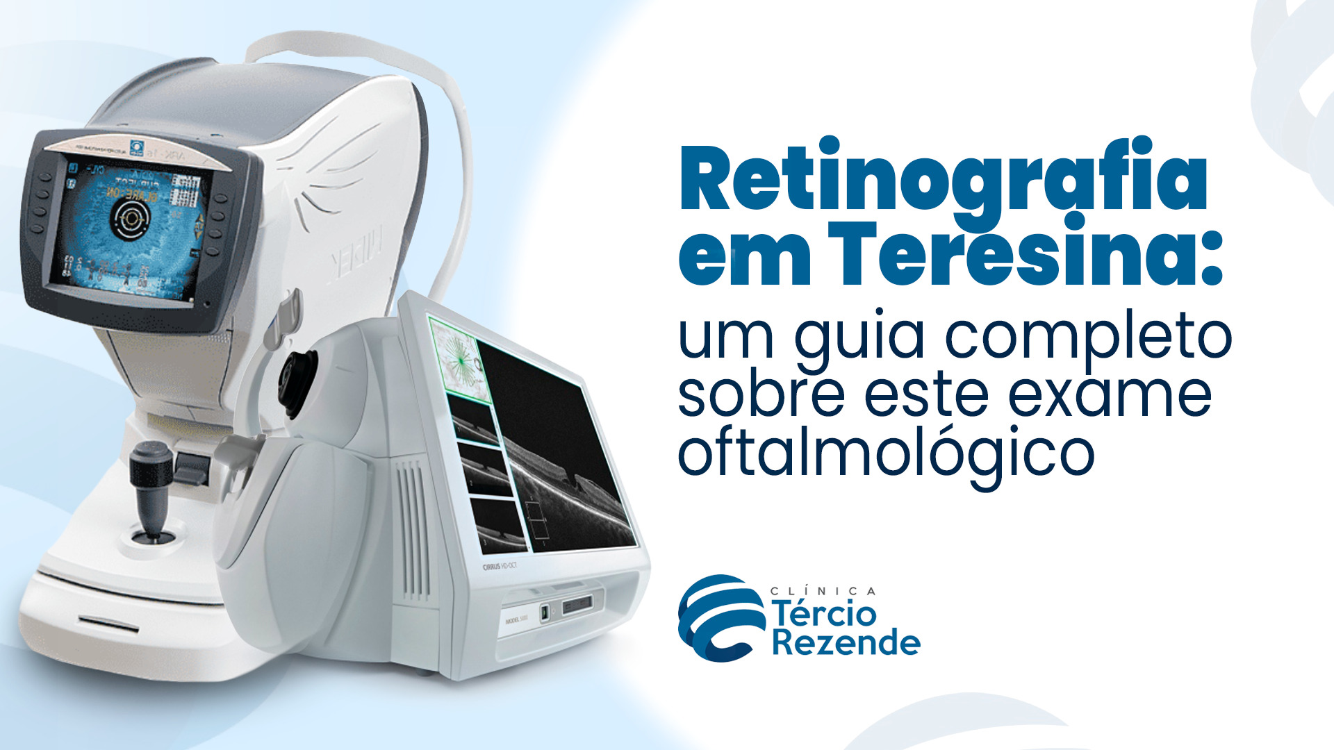 Retinografia em Teresina: um guia completo sobre este exame oftalmológico