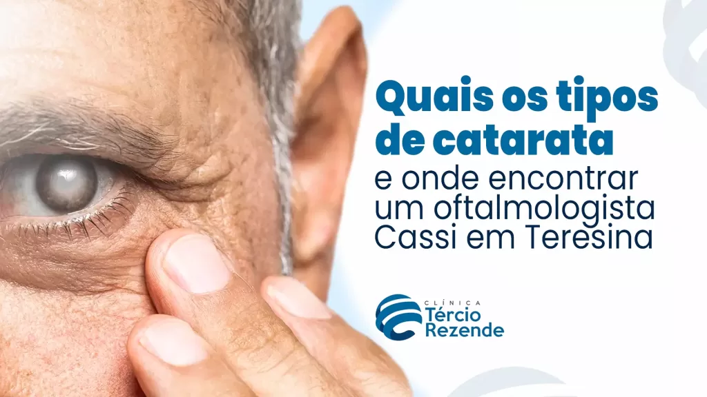 Catarata: onde encontrar um oftalmologista Cassi em Teresina